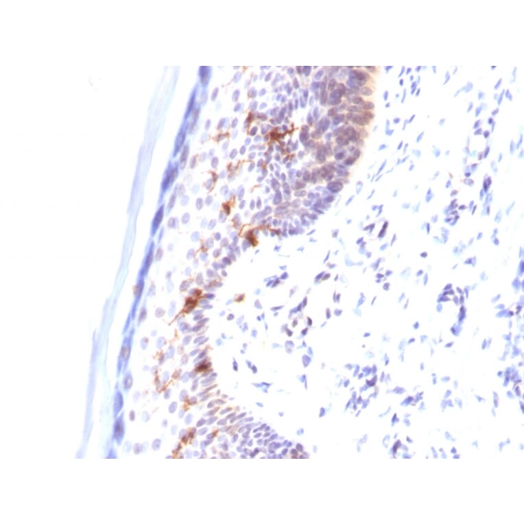 Immunohistochemistry - Anti-CD1a Antibody [C1A/711] (A250468) - Antibodies.com