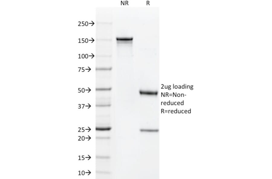 SDS-PAGE - Anti-CD1a Antibody [C1A/711] (A250469) - Antibodies.com