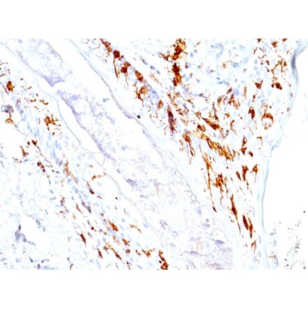 Immunohistochemistry - Anti-CD1a Antibody [O10+C1A/711] (A250469) - Antibodies.com