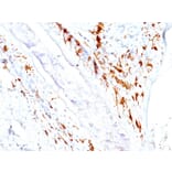 Immunohistochemistry - Anti-CD1a Antibody [O10+C1A/711] (A250469) - Antibodies.com