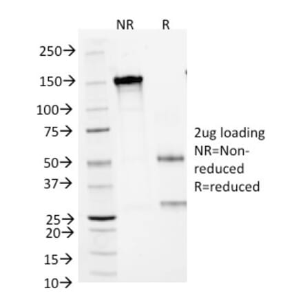 SDS-PAGE - Anti-CD1a Antibody [66IIC7] (A250471) - Antibodies.com
