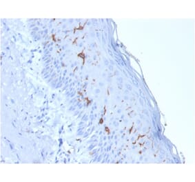 Immunohistochemistry - Anti-CD1a Antibody [rC1A/711] (A250473) - Antibodies.com