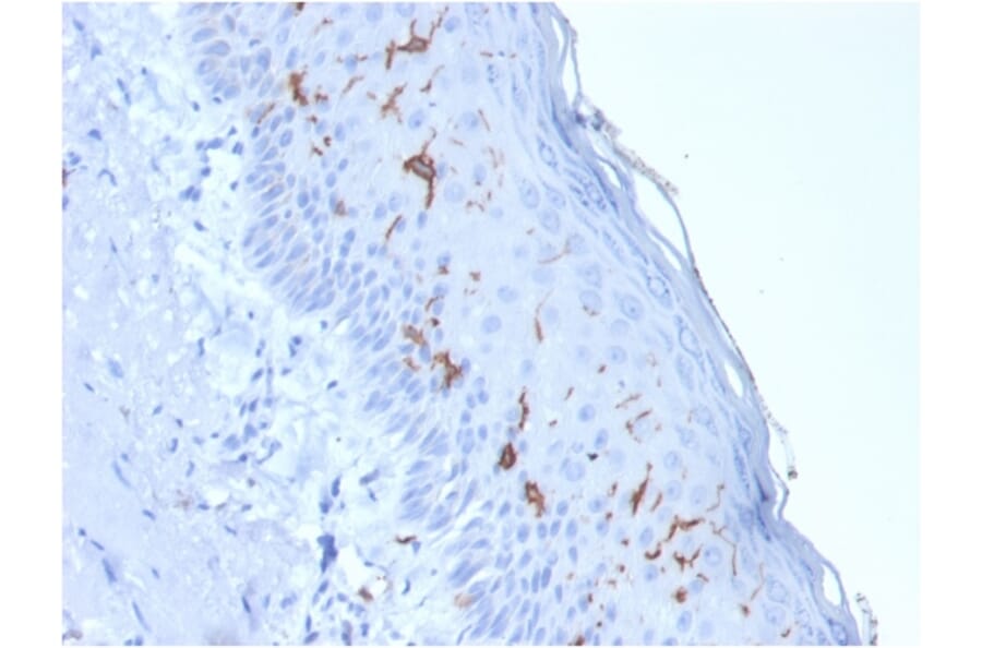 Immunohistochemistry - Anti-CD1a Antibody [rC1A/711] (A250473) - Antibodies.com