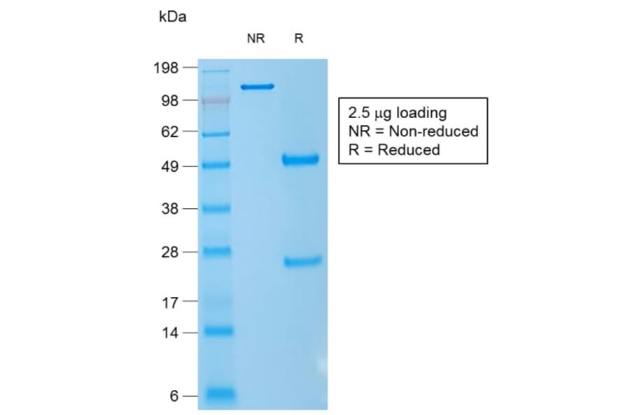 SDS-PAGE - Anti-CD1a Antibody [rC1A/711] (A250473) - Antibodies.com