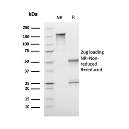 SDS-PAGE - Anti-CD1a Antibody [C1A/3249] (A250474) - Antibodies.com