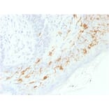 Immunohistochemistry - Anti-CD1a Antibody [C1A/1506R] (A250475) - Antibodies.com