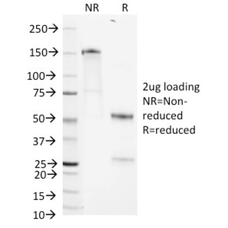 SDS-PAGE - Anti-CD1b Antibody [RIV12] (A250477) - Antibodies.com
