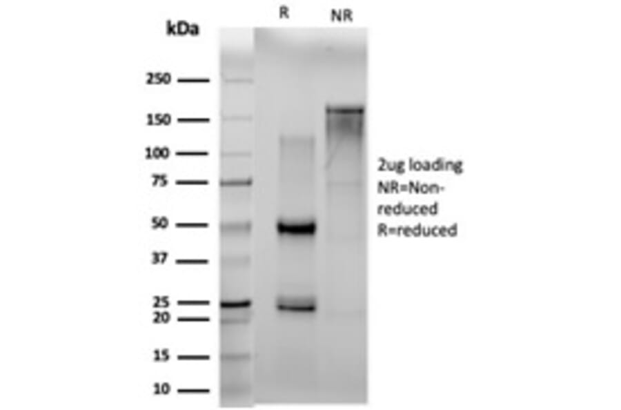 SDS-PAGE - Anti-N Myc Interactor Antibody [PCRP-NMI-1C1] (A250478) - Antibodies.com