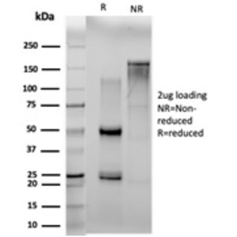 SDS-PAGE - Anti-N Myc Interactor Antibody [PCRP-NMI-1C1] (A250478) - Antibodies.com