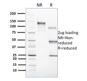 SDS-PAGE - Anti-CD1c Antibody [CD1C/1603] (A250478) - Antibodies.com