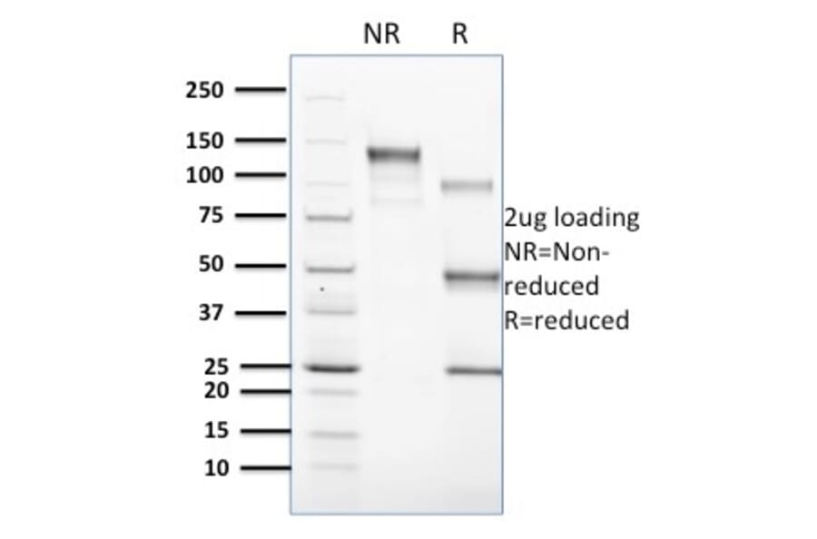 SDS-PAGE - Anti-CD1c Antibody [CD1C/1603] (A250478) - Antibodies.com