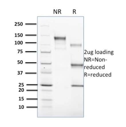 SDS-PAGE - Anti-CD1c Antibody [CD1C/1603] (A250478) - Antibodies.com