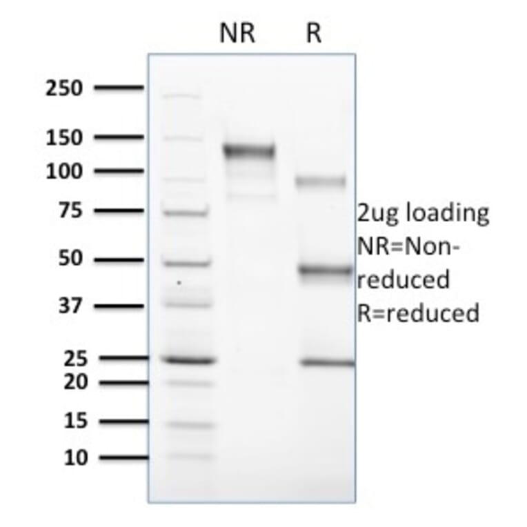 SDS-PAGE - Anti-CD1c Antibody [CD1C/1603] (A250478) - Antibodies.com