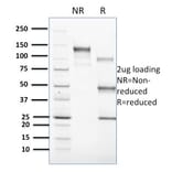 SDS-PAGE - Anti-CD1c Antibody [CD1C/1603] (A250478) - Antibodies.com