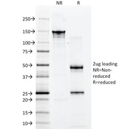 SDS-PAGE - Anti-CD2 Antibody [1E7E8.G4] (A250482) - Antibodies.com