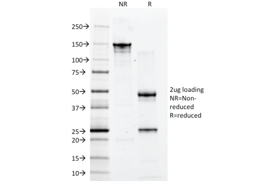 SDS-PAGE - Anti-CD2 Antibody [1E7E8.G4] (A250482) - Antibodies.com