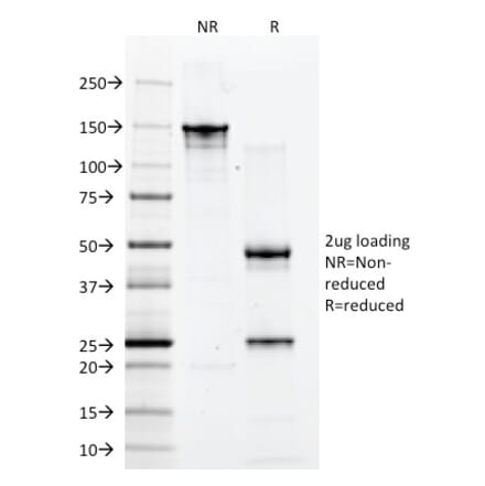 SDS-PAGE - Anti-CD2 Antibody [1E7E8.G4] (A250482) - Antibodies.com