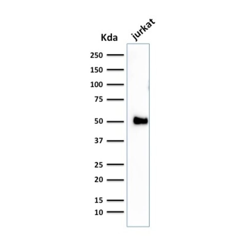 Western Blot - Anti-CD2 Antibody [1E7E8.G4] (A250482) - Antibodies.com