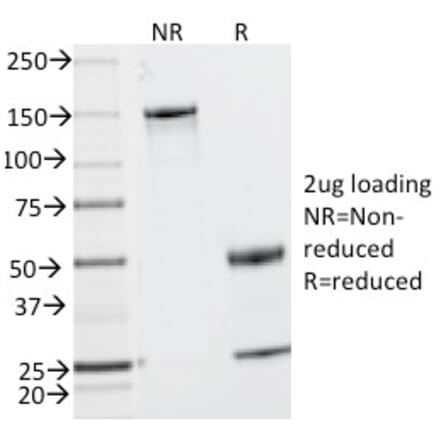 SDS-PAGE - Anti-CD2 Antibody [UMCD2] (A250483) - Antibodies.com