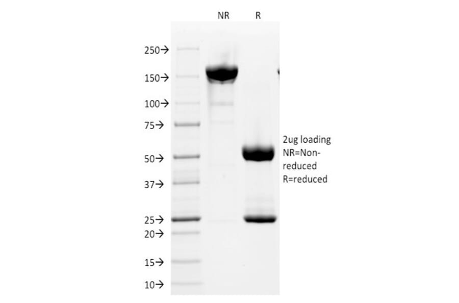 SDS-PAGE - Anti-CD2 Antibody [HuLy-m1] (A250485) - Antibodies.com