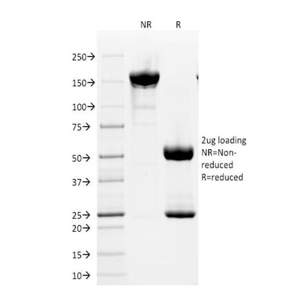 SDS-PAGE - Anti-CD2 Antibody [HuLy-m1] (A250485) - Antibodies.com