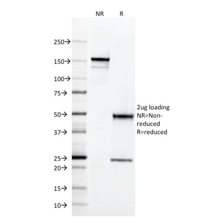 SDS-PAGE - Anti-CD2 Antibody [RPA-2.10] (A250485) - Antibodies.com