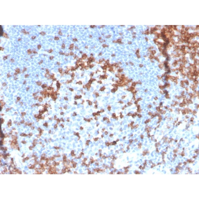 Immunohistochemistry - Anti-CD2 Antibody [LFA2/3417R] (A250488) - Antibodies.com