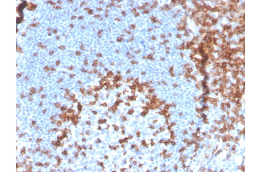 Immunohistochemistry - Anti-CD2 Antibody [LFA2/3417R] (A250487) - Antibodies.com