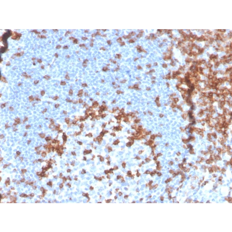 Immunohistochemistry - Anti-CD2 Antibody [LFA2/3417R] (A250487) - Antibodies.com