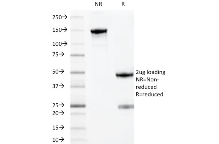 SDS-PAGE - Anti-MYADM Antibody [MYADM/971] (A250489) - Antibodies.com