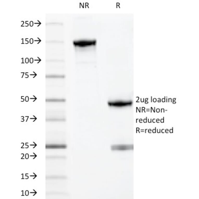 SDS-PAGE - Anti-MYADM Antibody [MYADM/971] (A250489) - Antibodies.com