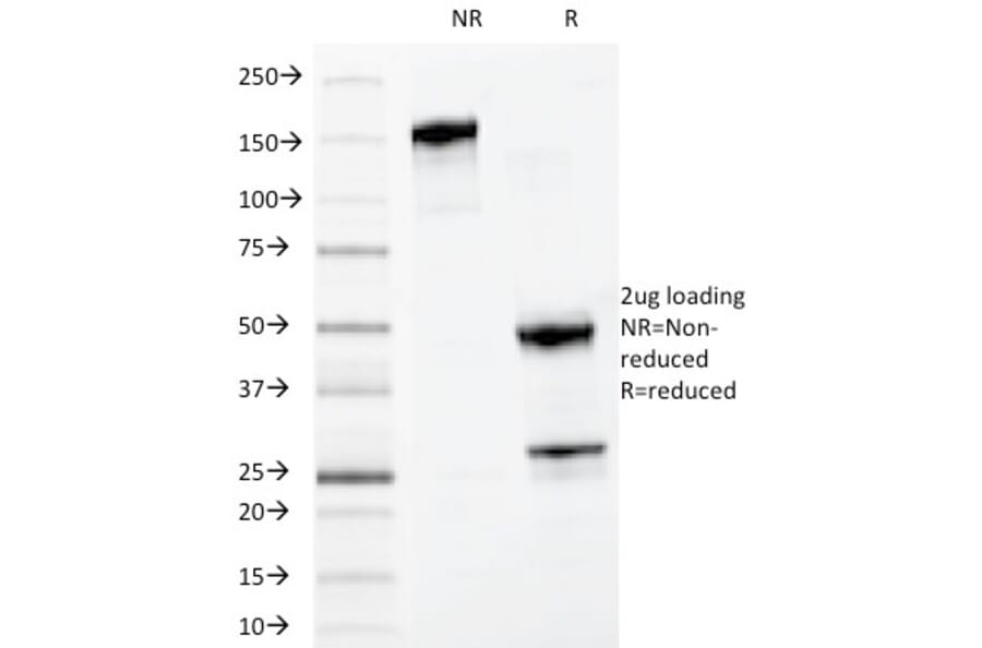 SDS-PAGE - Anti-MYADM Antibody [MYADM/972] (A250490) - Antibodies.com