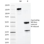 SDS-PAGE - Anti-MYADM Antibody [MYADM/972] (A250490) - Antibodies.com