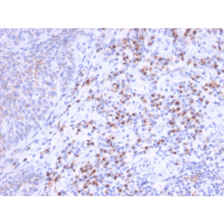 Immunohistochemistry - Anti-RCAS1 Antibody [CPTC-EBAG9-1] (A250491) - Antibodies.com