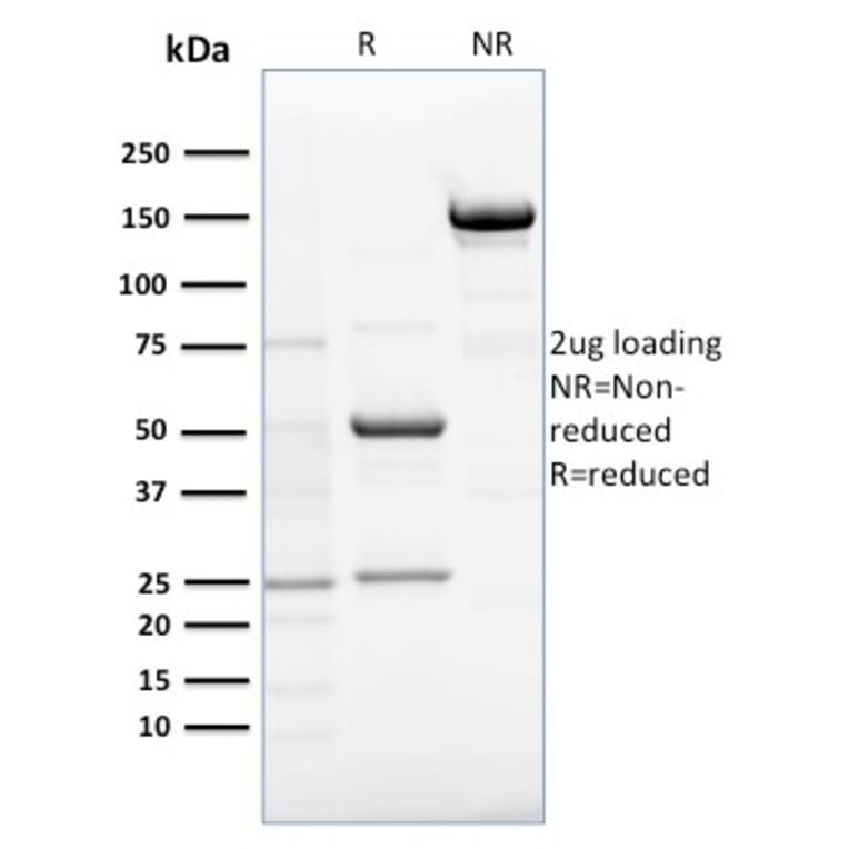 SDS-PAGE - Anti-RCAS1 Antibody [CPTC-EBAG9-1] (A250491) - Antibodies.com