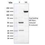 SDS-PAGE - Anti-RCAS1 Antibody [CPTC-EBAG9-1] (A250491) - Antibodies.com