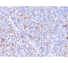 Immunohistochemistry - Anti-RCAS1 Antibody [CPTC-EBAG9-2] (A250491) - Antibodies.com