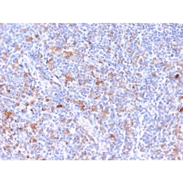 Immunohistochemistry - Anti-RCAS1 Antibody [CPTC-EBAG9-2] (A250491) - Antibodies.com