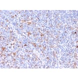 Immunohistochemistry - Anti-RCAS1 Antibody [CPTC-EBAG9-2] (A250491) - Antibodies.com