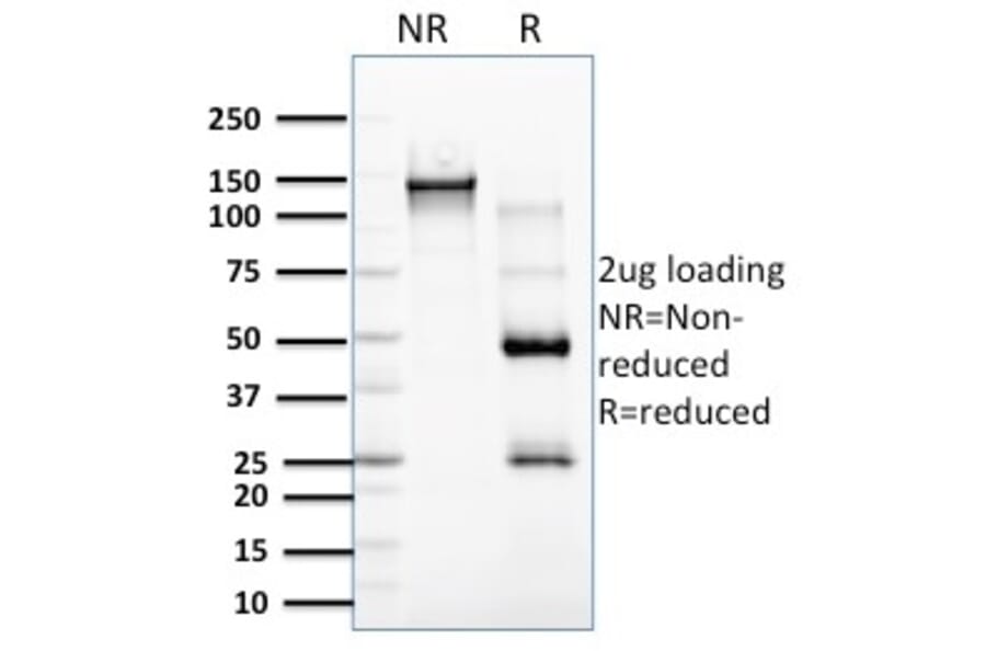 SDS-PAGE - Anti-RCAS1 Antibody [CPTC-EBAG9-2] (A250492) - Antibodies.com