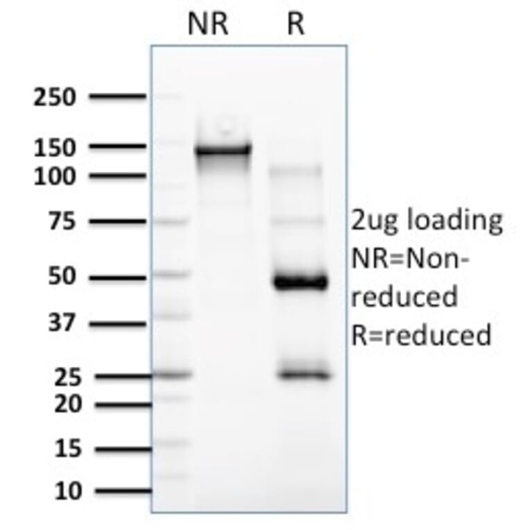 SDS-PAGE - Anti-RCAS1 Antibody [CPTC-EBAG9-2] (A250492) - Antibodies.com