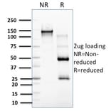 SDS-PAGE - Anti-RCAS1 Antibody [CPTC-EBAG9-2] (A250492) - Antibodies.com