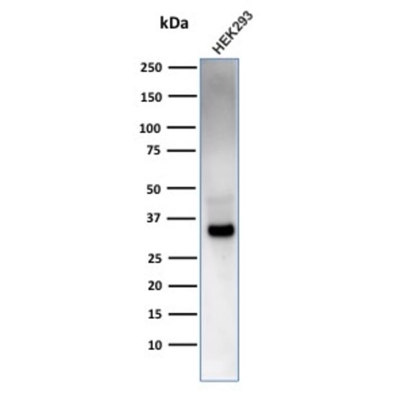 Western Blot - Anti-RCAS1 Antibody [CPTC-EBAG9-2] (A250492) - Antibodies.com