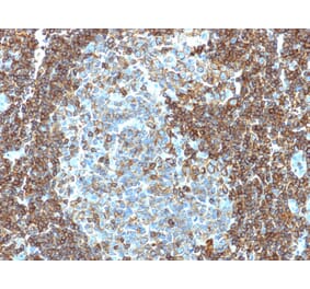 Immunohistochemistry - Anti-CD3 epsilon Antibody [PC3/188A] (A250492) - Antibodies.com