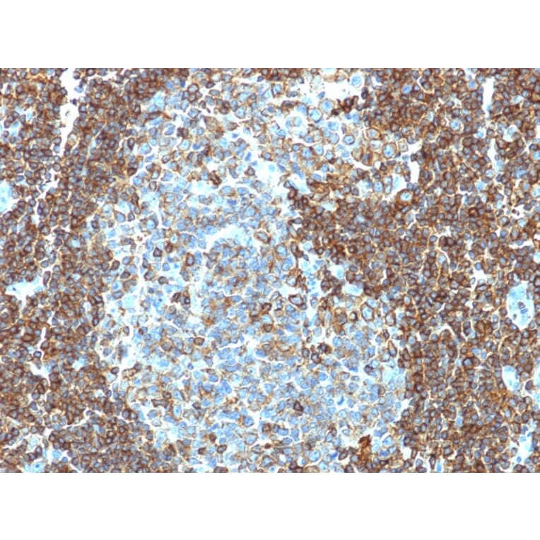 Immunohistochemistry - Anti-CD3 epsilon Antibody [PC3/188A] (A250492) - Antibodies.com