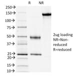 SDS-PAGE - Anti-CD3 epsilon Antibody [PC3/188A] (A250493) - Antibodies.com