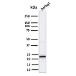 Western Blot - Anti-CD3 epsilon Antibody [PC3/188A] (A250493) - Antibodies.com