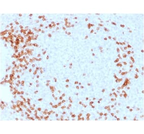 Immunohistochemistry - Anti-CD3 epsilon Antibody [C3e/1931] (A250494) - Antibodies.com
