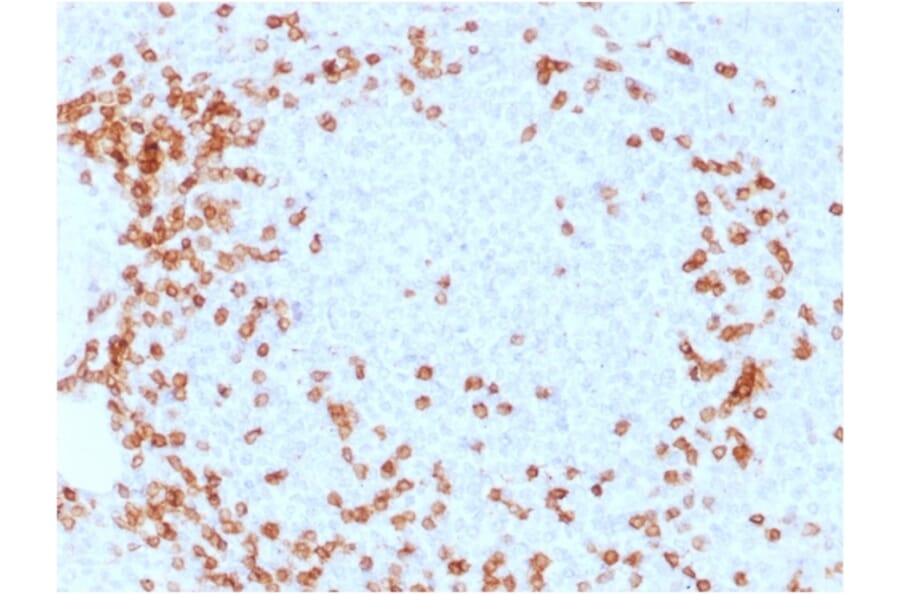 Immunohistochemistry - Anti-CD3 epsilon Antibody [C3e/1931] (A250494) - Antibodies.com