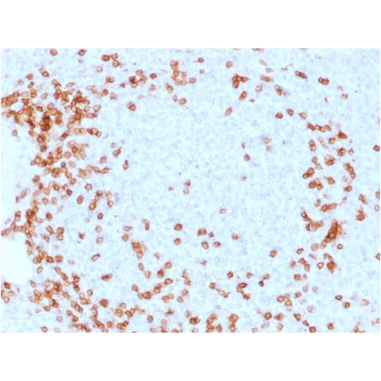 Immunohistochemistry - Anti-CD3 epsilon Antibody [C3e/1931] (A250494) - Antibodies.com